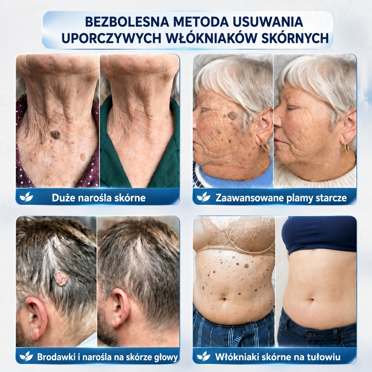 𝐏𝐢𝐜𝐝𝐨® 𝟕-𝐓𝐚𝐠𝐞 𝐇𝐚𝐮𝐭𝐚𝐧𝐡ä𝐧𝐠𝐬𝐞𝐥- & 𝐅𝐥𝐞𝐜𝐤𝐞𝐧-𝐄𝐧𝐭𝐟𝐞𝐫𝐧𝐮𝐧𝐠𝐬𝐜𝐫𝐞𝐦𝐞 (𝐒𝐜𝐡𝐦𝐞𝐫𝐳𝐟𝐫𝐞𝐢𝐞 𝐅𝐨𝐫𝐦𝐞𝐥 – 𝐨𝐡𝐧𝐞 𝐍𝐚𝐫𝐛𝐞𝐧)🍕