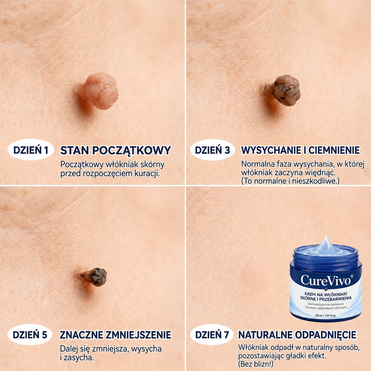 𝐏𝐢𝐜𝐝𝐨® 𝟕-𝐓𝐚𝐠𝐞 𝐇𝐚𝐮𝐭𝐚𝐧𝐡ä𝐧𝐠𝐬𝐞𝐥- & 𝐅𝐥𝐞𝐜𝐤𝐞𝐧-𝐄𝐧𝐭𝐟𝐞𝐫𝐧𝐮𝐧𝐠𝐬𝐜𝐫𝐞𝐦𝐞 (𝐒𝐜𝐡𝐦𝐞𝐫𝐳𝐟𝐫𝐞𝐢𝐞 𝐅𝐨𝐫𝐦𝐞𝐥 – 𝐨𝐡𝐧𝐞 𝐍𝐚𝐫𝐛𝐞𝐧)🍕
