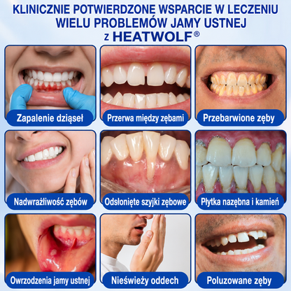 🇵🇱👨‍⚕️✅🦷HEATWOLF® GumRevive Żel naprawczy przy paradontozie🍔