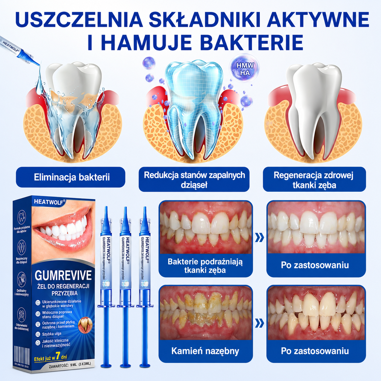 🇵🇱👨‍⚕️✅🦷HEATWOLF® GumRevive Żel naprawczy przy paradontozie🍔