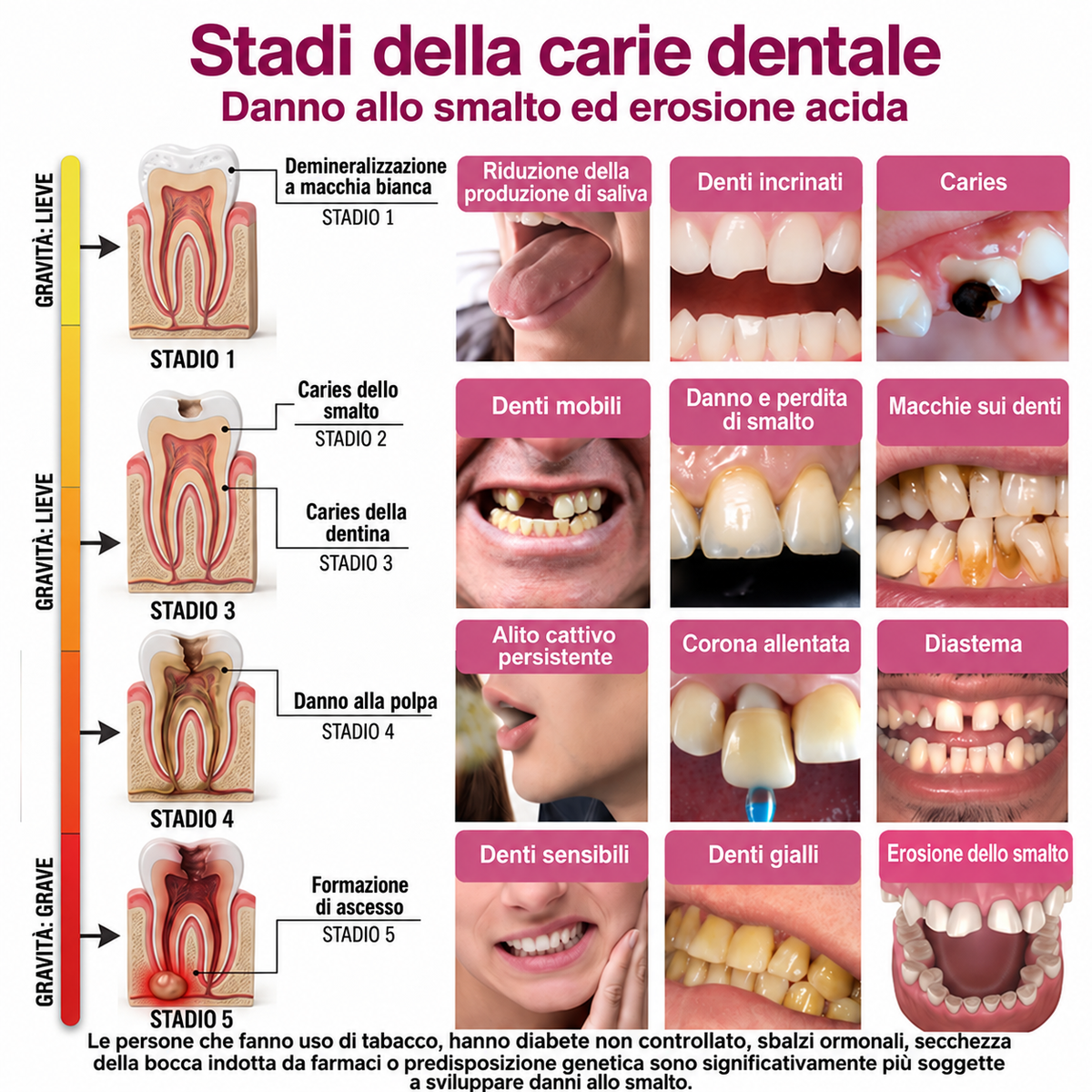 HEATWOLF® DenPerm Gel per il riempimento delle carie e la rigenerazione naturale dello smalto dentale🎈