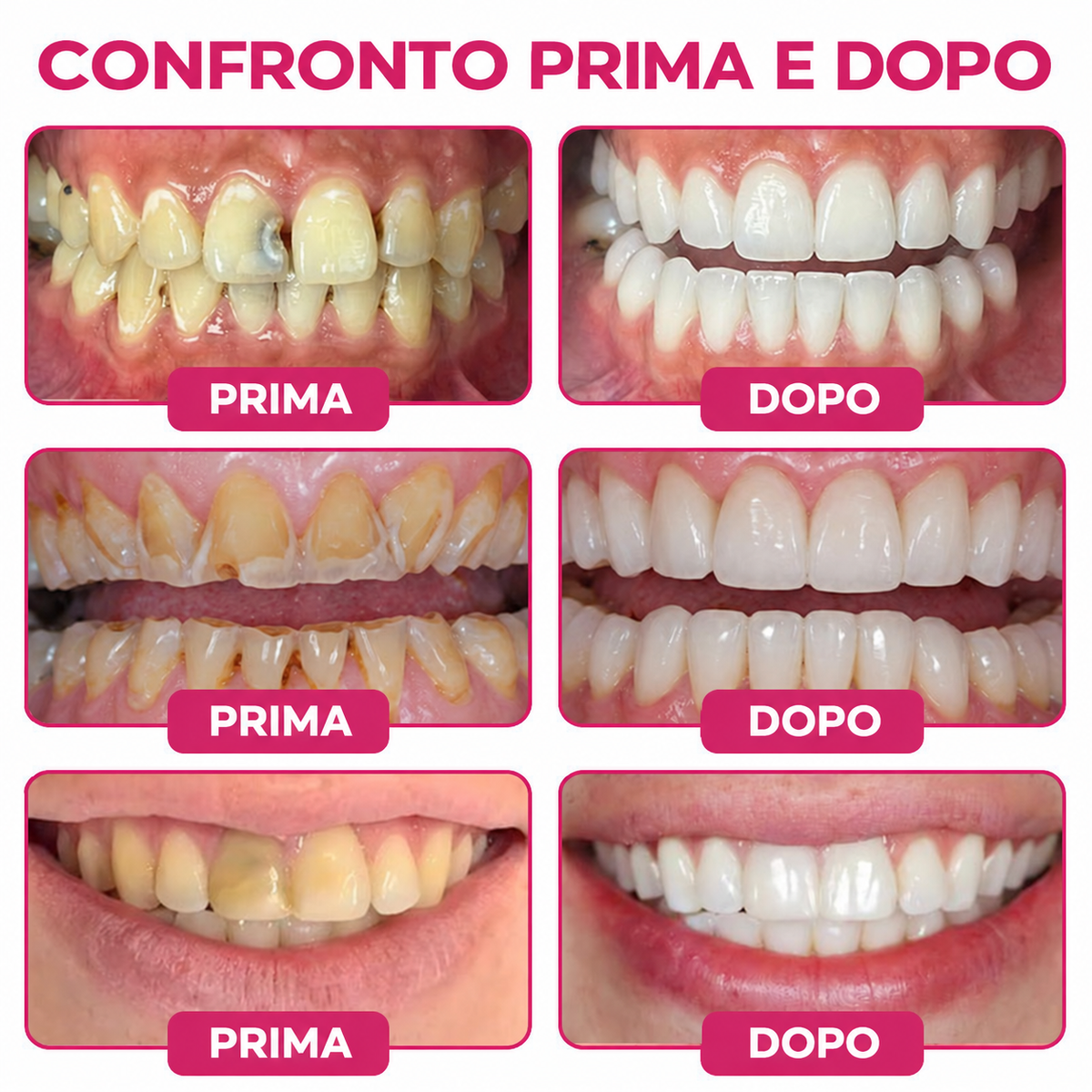 🇺🇸Rolimey® DenPerm Cavity-Repair Natural Enamel Filling Gel